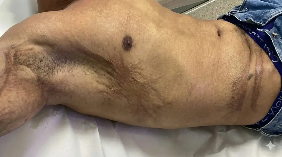 Before treatment